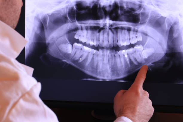 Best Emergency Tooth Extraction in Newport, TN