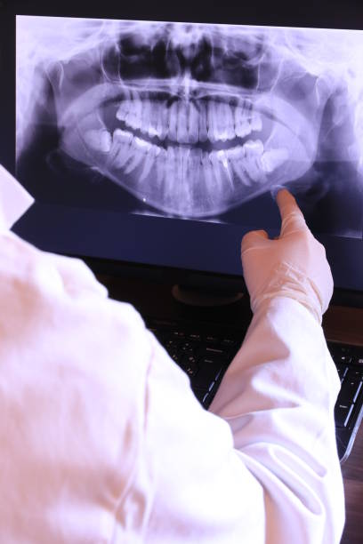 Best Emergency Wisdom Teeth Removal in Newport, TN